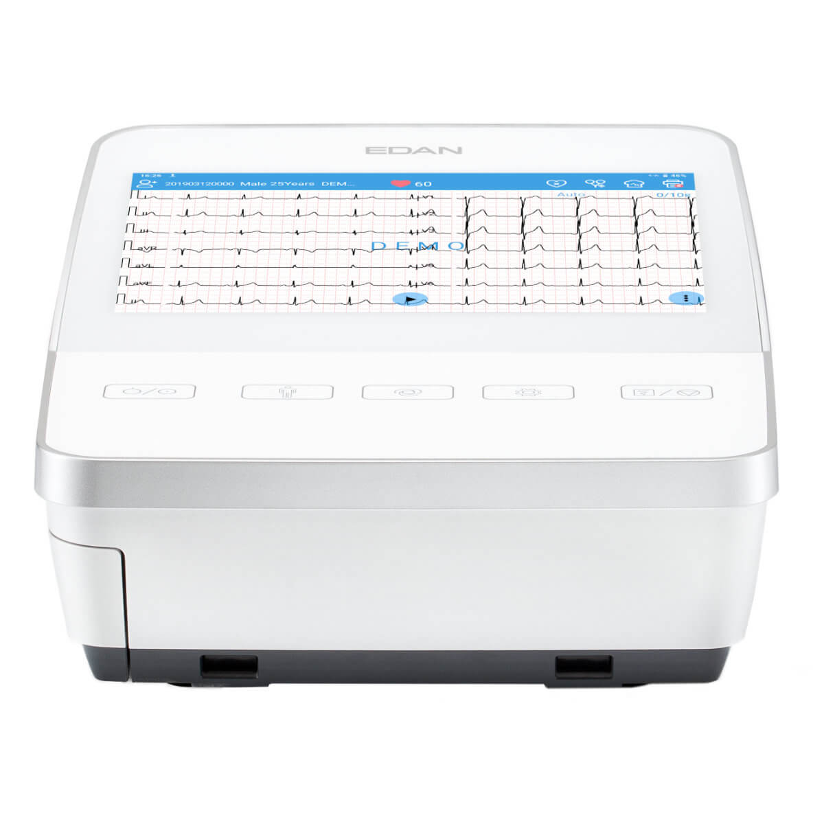 Appareil ECG 12 Pistes SE-1200 Pro EDAN pour Diagnostic Précis