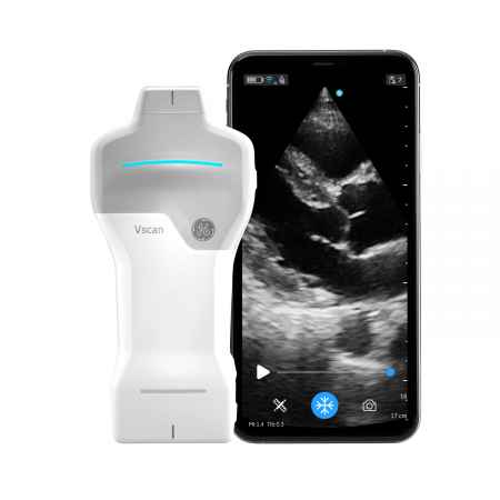 Charge rapide Station Vscan Air™ SL pour Ultrason