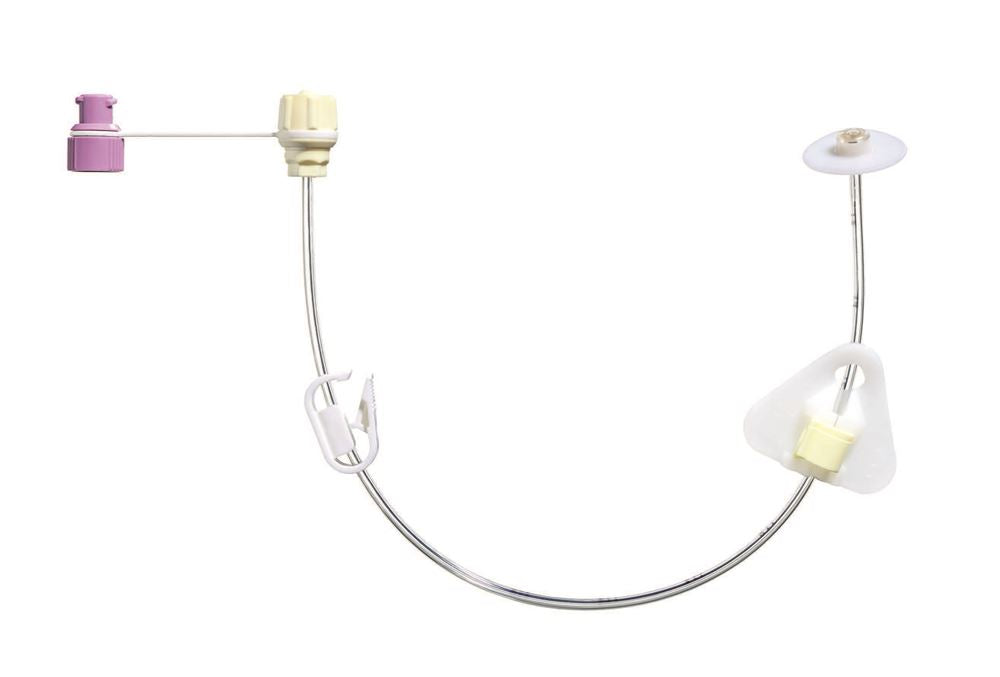 FREKA PEG Set Gastrique CH9 30cm | ENFit