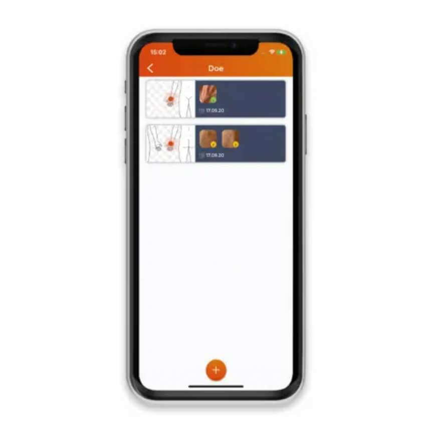 Dermatoscopie HEINE iC1 - Appareil Innovant pour iPhone