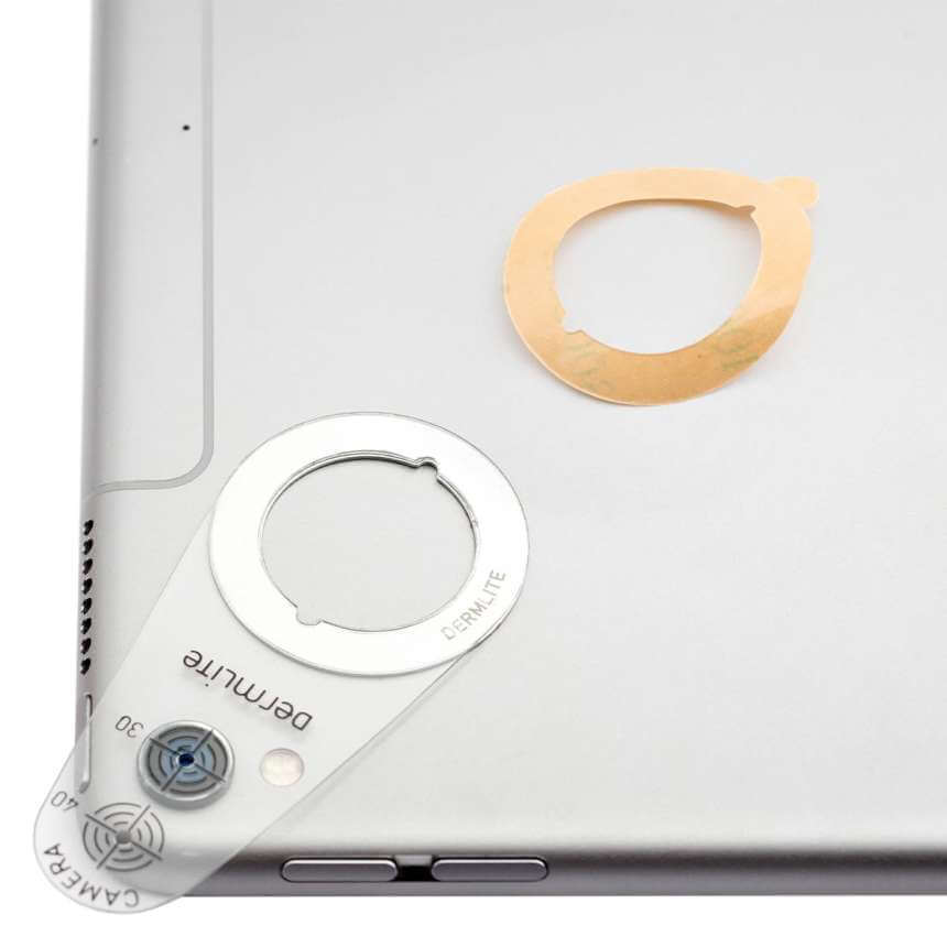 DermLite Handyscope: Transformez votre Mobile en Dermatoscope Portable