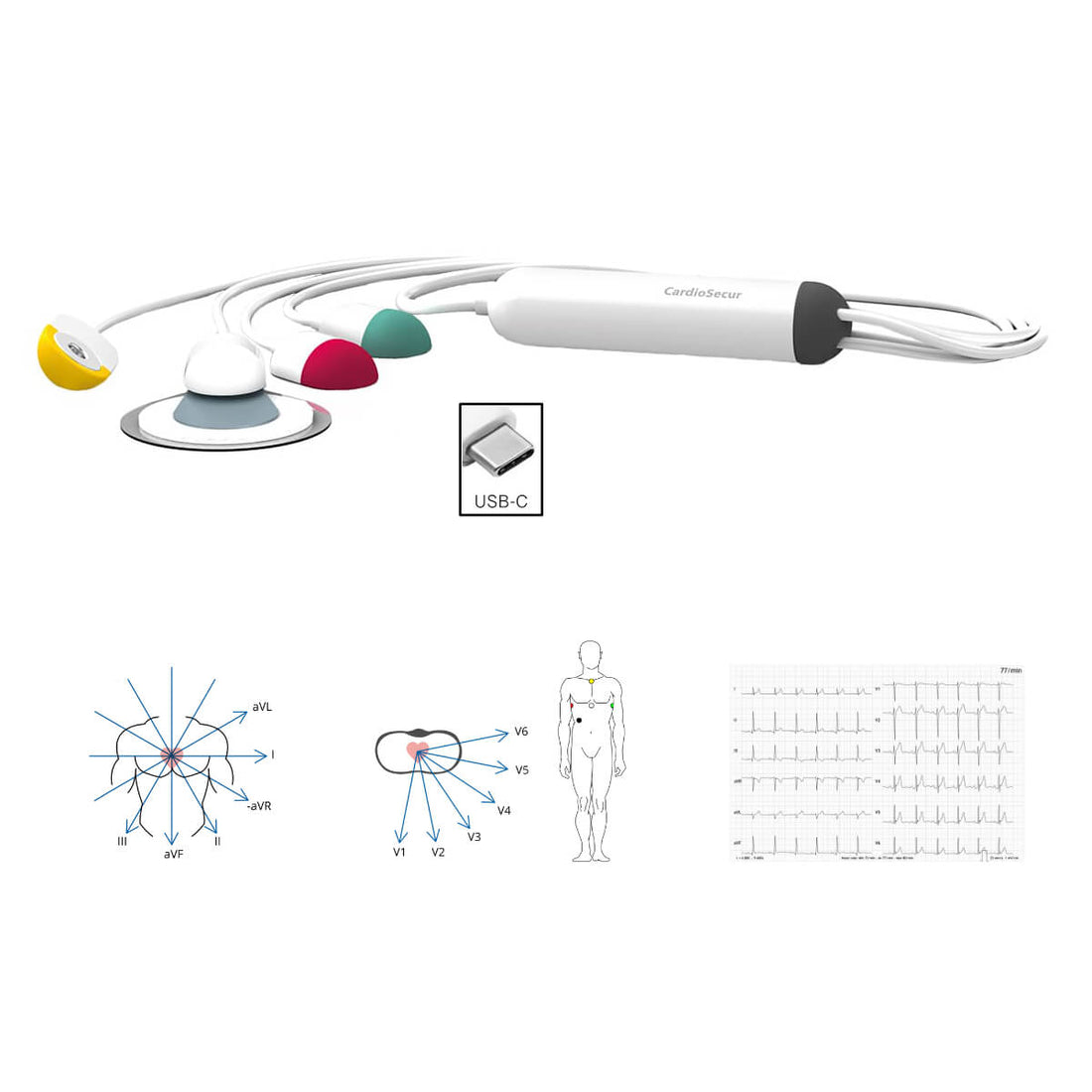 https://dccdn.de/www.doccheckshop.at/media/image/69/83/74/103423-0-CardioSecur-Pro-EKG-12-usb_c-1.jpg