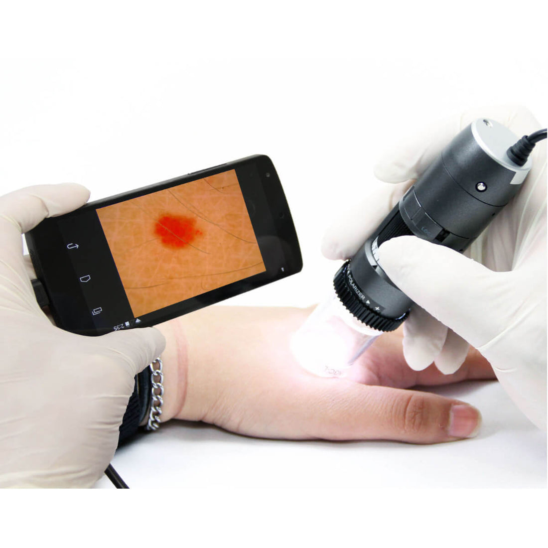 Dino-Lite Dermatoscope Vidéo Polarizer HR 200x pour Dermatologie