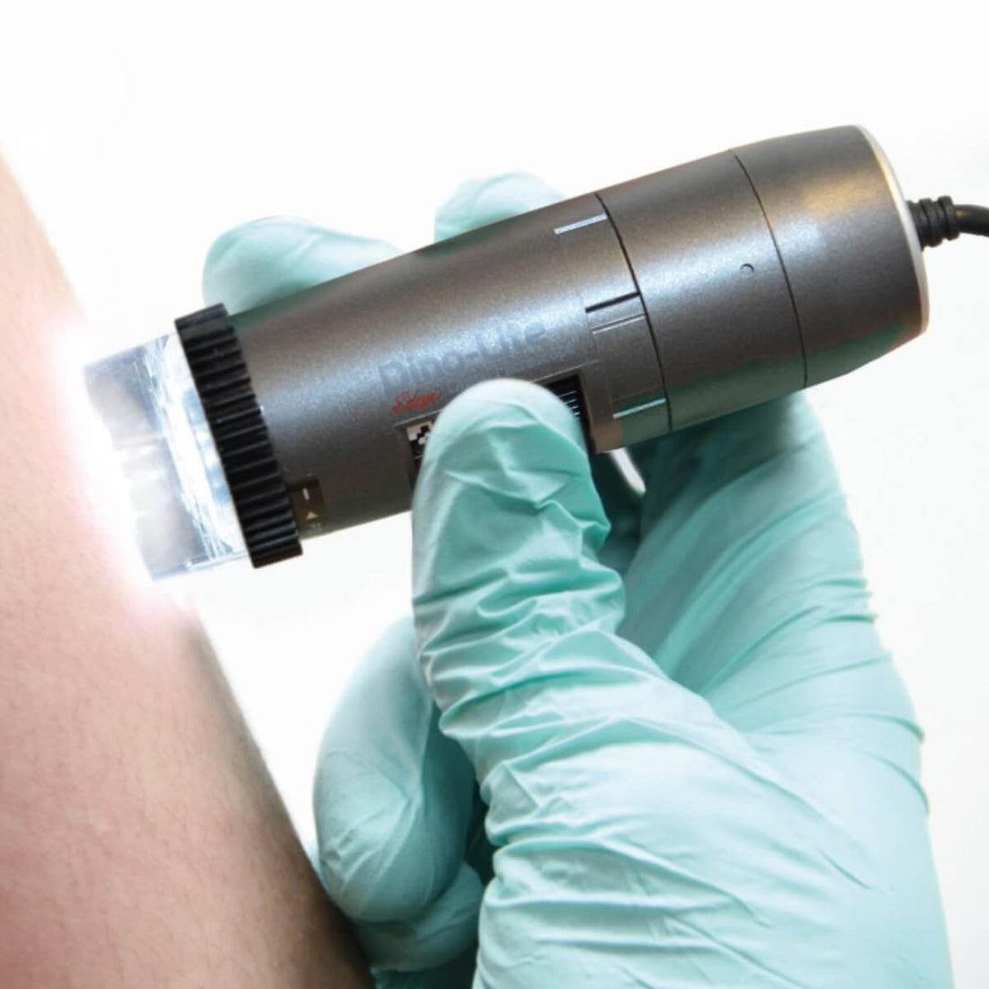 Dino-Lite Dermatoscope Vidéo Polarizer HR 200x pour Dermatologie
