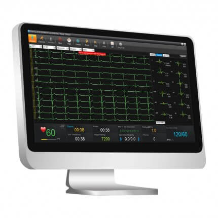 EDAN Logiciel de Gestion de Données ECG SE-1515 pour Médical