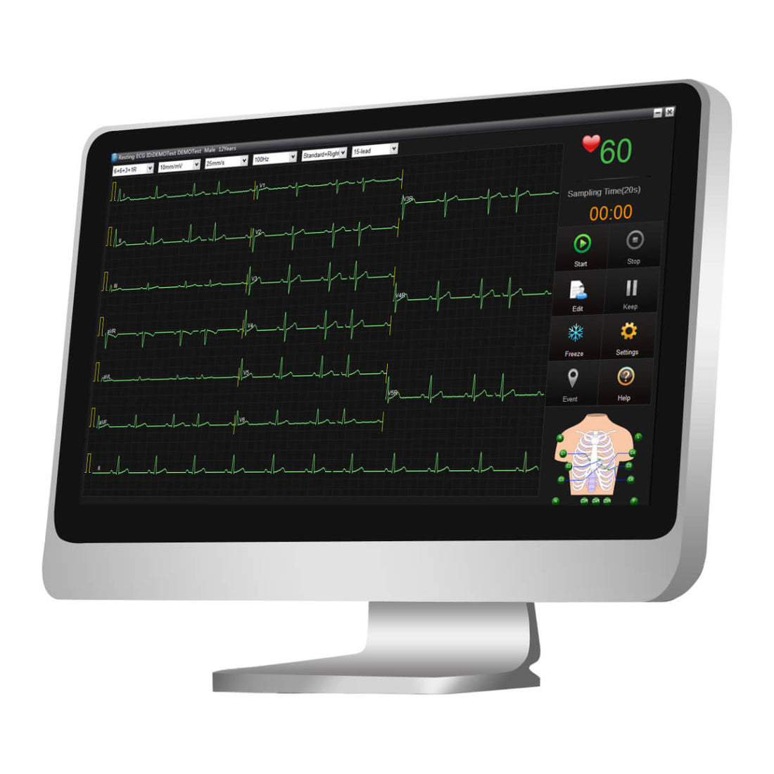 EDAN Logiciel de Gestion de Données ECG SE-1515 pour Médical